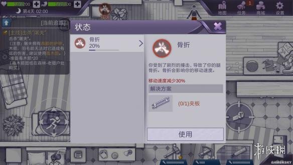 《阿瑞斯病毒》遭遇骨折怎么办 骨折处理方法介绍 1